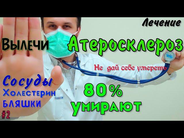 Атеросклероз / Холестерин. главные Причины. Лечение, как очистить сосуды/от бляшки и жить долго.