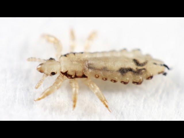 Head Lice - Boys Town Pediatrics