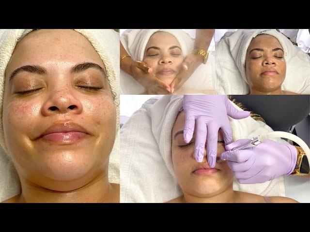 GLASS SKIN FACIAL TREATMENT | NO HYPERPIGMENTATION + PLUMP