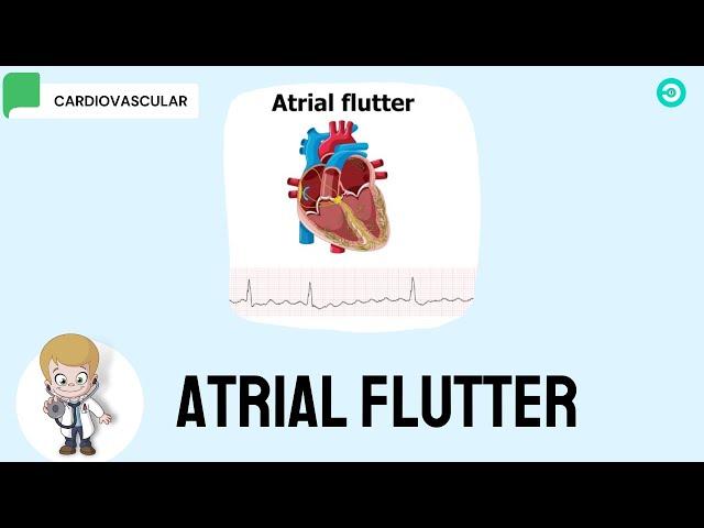 Atrial Flutter: symptoms, ECG features and Treatment options