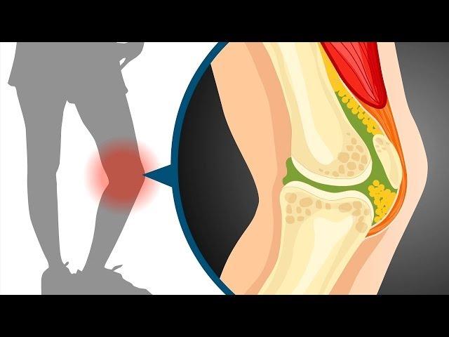 Sliding filament theory in muscle contraction | Wellcome