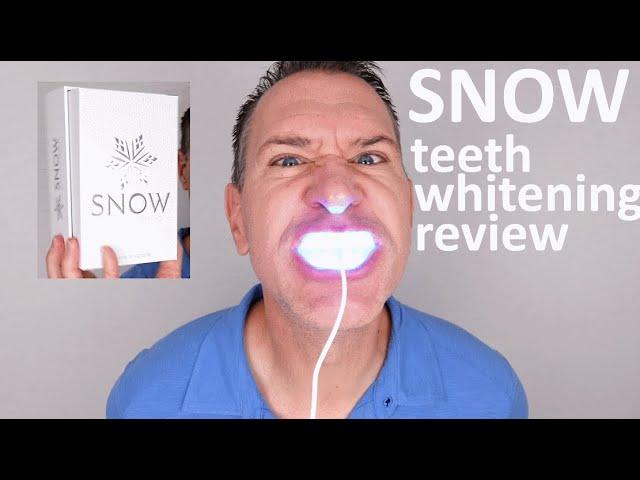 SNOW Teeth Whitening Review & Unboxing 2020 - Does Snow really work?