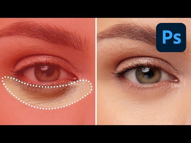 Eliminate Dark Circles and Brighten Eyes in Photoshop