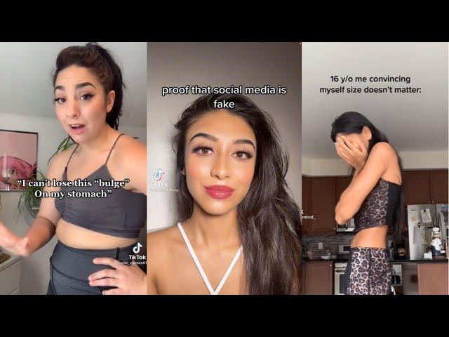 Embracing Body Insecurities | Self Love & Body Positivity