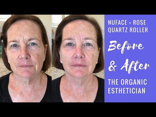 Anti-Aging NuFace Microcurrent  + Rose Quartz Roller Before & After on My Mom