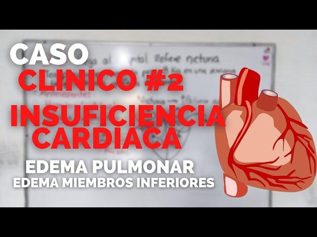 Paciente MASCULINO llega a URGENCIAS por INSUFICIENCIA CARDIACA | CASO CLINICO #2 | ENFERMERIA