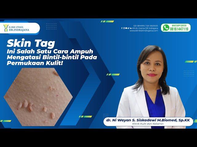 INI SALAH SATU CARA AMPUH MENGATASI BINTIL-BINTIL SKIN TAG PADA PERMUKAAN KULIT!