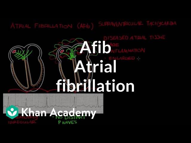 Atrial fibrillation (Afib) | Circulatory System and Disease | NCLEX-RN | Khan Academy