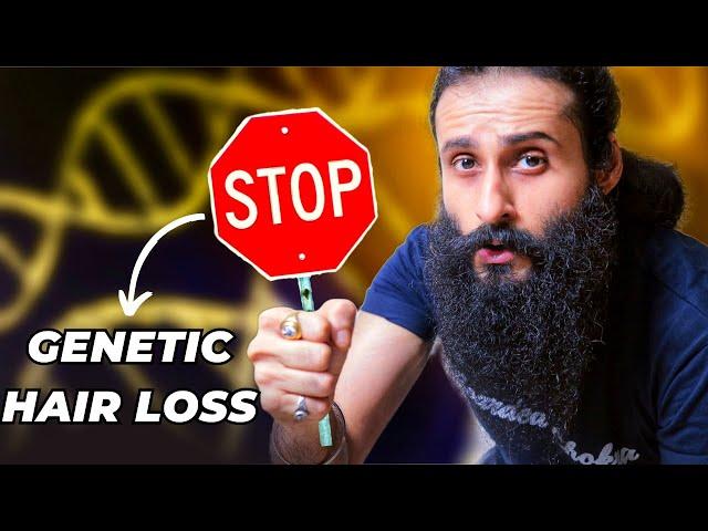 Stop Blaming Your Genetics For Hair Loss - Fix This Instead | Bearded Chokra