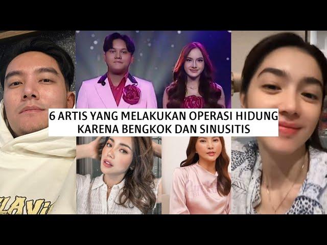 6 ARTIS YANG MELAKUKAN OPERASI HIDUNG KARENA BENGKOK DAN SINUSITIS