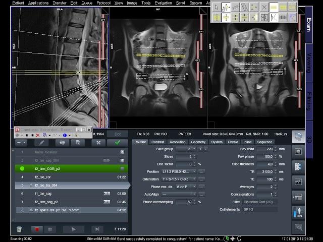 MRI planning L-spine