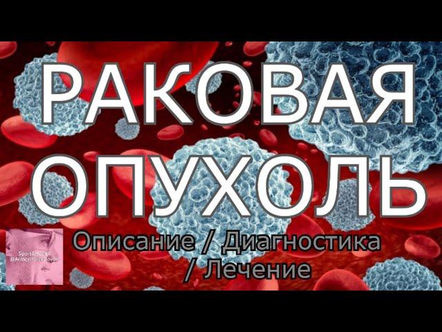 РАКОВАЯ ОПУХОЛЬ Описание/ Диагностика  / Лечение