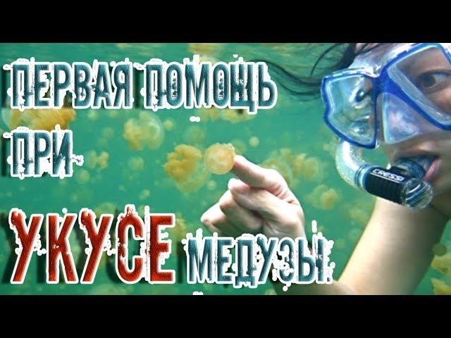 ЗдоровьеПервая помощь при укусе медузыЭто полезно знать