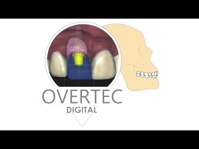 PPR Digital em OverPeek