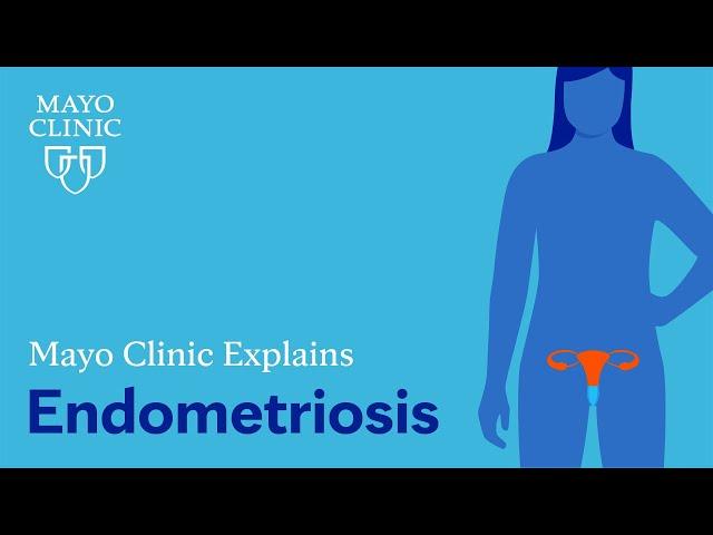 Mayo Clinic Explains Endometriosis