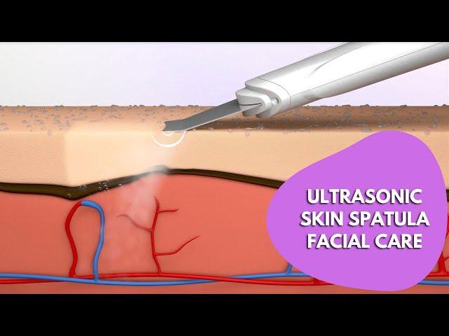 Ultrasonic Skin Spatula Facial | Ultrasonic Skin Scrubber Spatula| Blackhead Removal Exfoliation