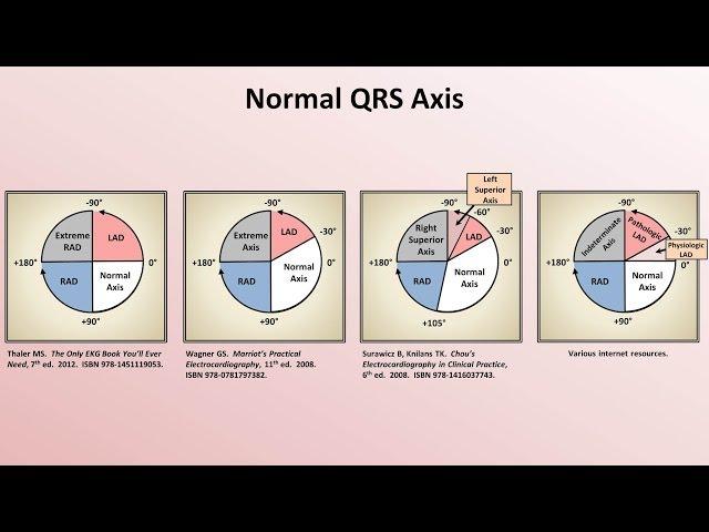 Intro to EKG Interpretation - Rate and Axis