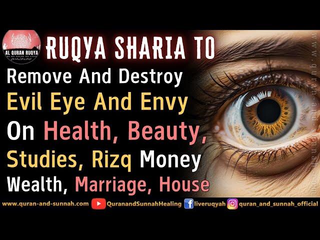 Ruqyah To Remove Evil Eye And Envy On Health, Beauty, Studies, Rizq, Wealth, Marriage And House.