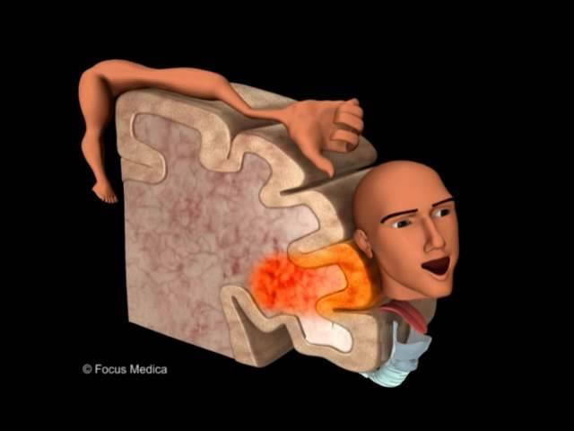 Primary Motor Cortex - Neuroanatomy