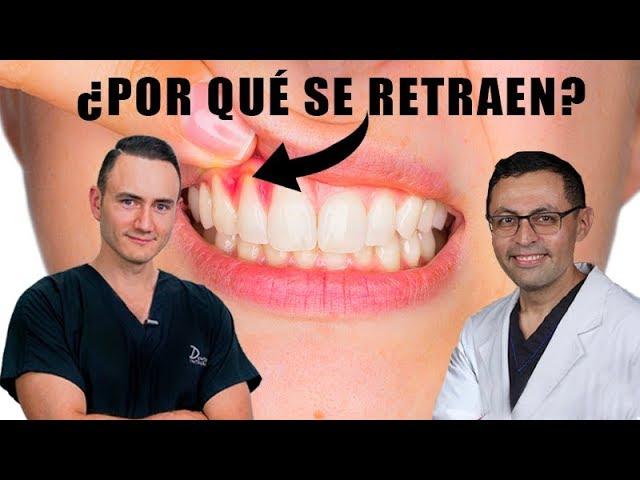 ¿Por qué se retraen las encías? | Causa, Tratamiento y Costo