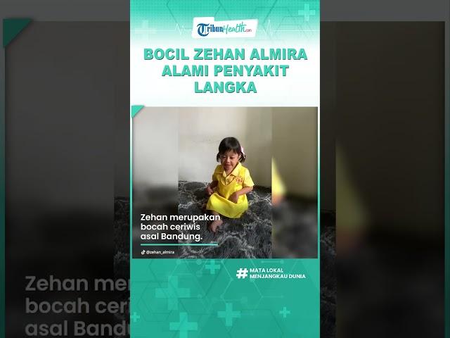 Bocil Zehan Almira Alami Penyakit Langka Osteogenesis Imperfecta