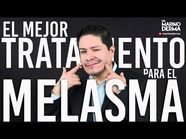 Elimina manchas de paño o melasma en la piel con estos 8 tratamientos || Dr Marino Dermatologo