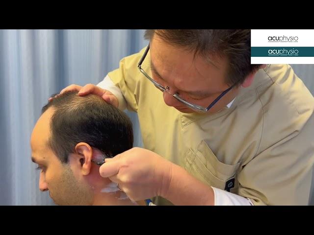 Chinese massage for tinnitus