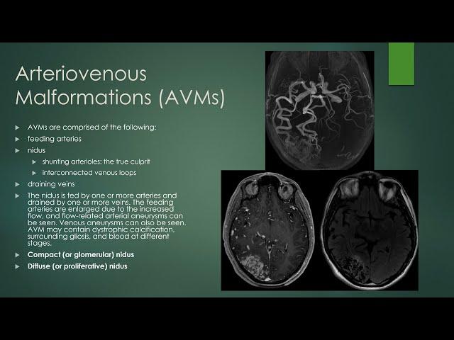 Brain vascular malformations