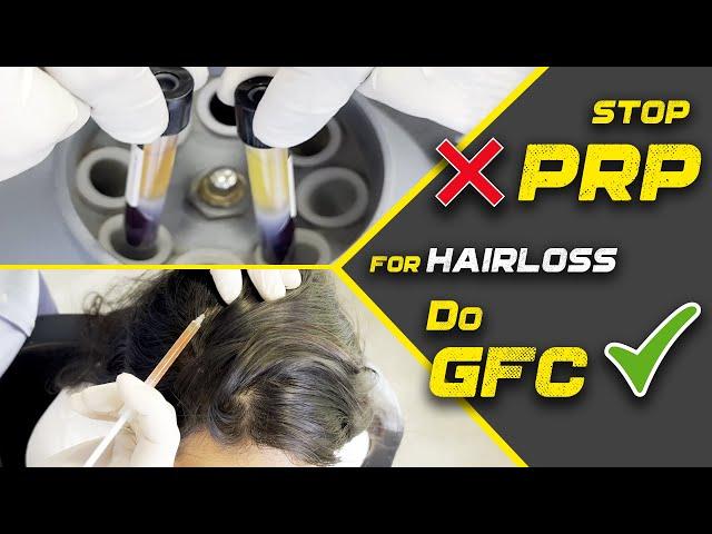 5 Reasons Why GFC is Better than PRP | Treatment for Hair loss | GFC Hair Treatment in India, Mumbai