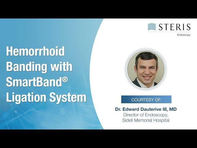 Hemorrhoid Banding Using the SMARTBAND™ Multi-Band Ligation System | STERIS