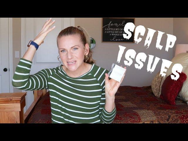 How I Fixed My Scalp Issues ft. Innate Life