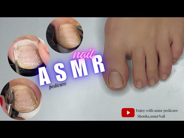 asmr nail | asmr pedicure cleaning