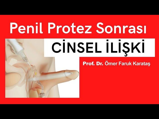 Penil Protez Ameliyatından Sonra Cinsel İlişki - Prof. Dr. Ömer Faruk Karataş