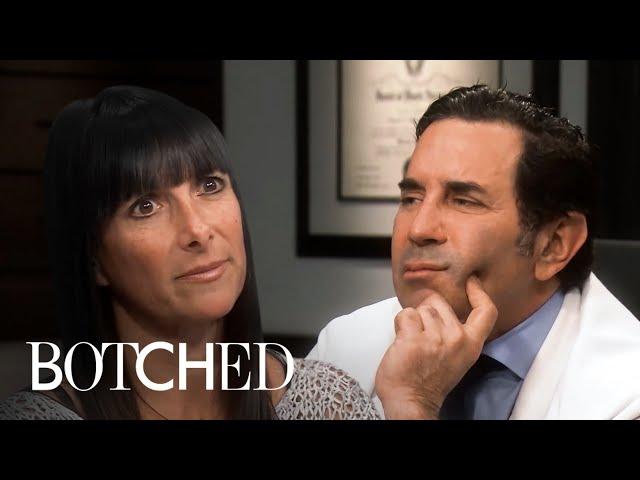 4 Patients Who Just Want to Look Normal After Botched Procedures | E!