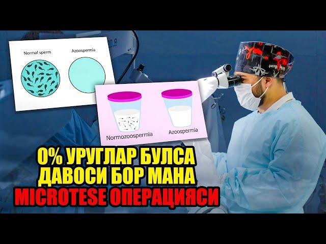 Бепуштлик. Спермограмма 0% булса мана операцияси бор…