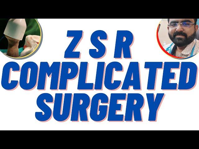 ZSR Circumcision | Difficult surgery | 60+ yr OLD patient | BXO PHIMOSIS | Do not IGNORE Phimosis !