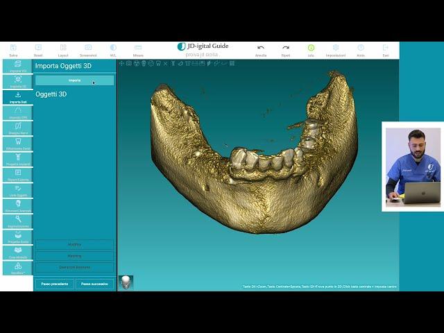 Progettazione Chirurgia Computer Guidata con Software RealGuide