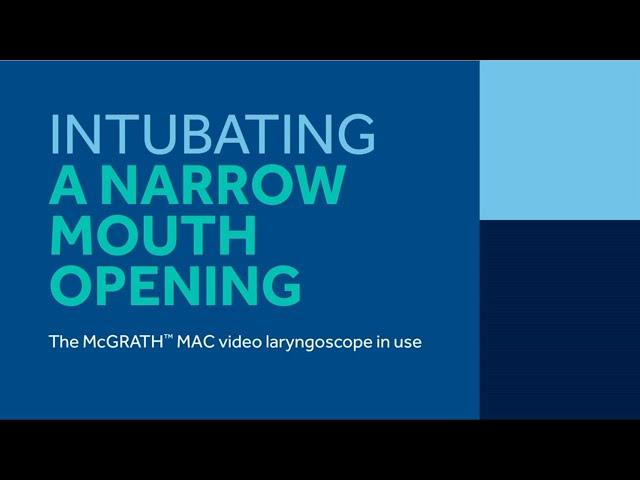 Intubation of a Narrow mouth Opening with McGrath™ MAC video Laryngoscope