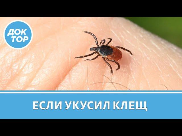 Если укусил клещ