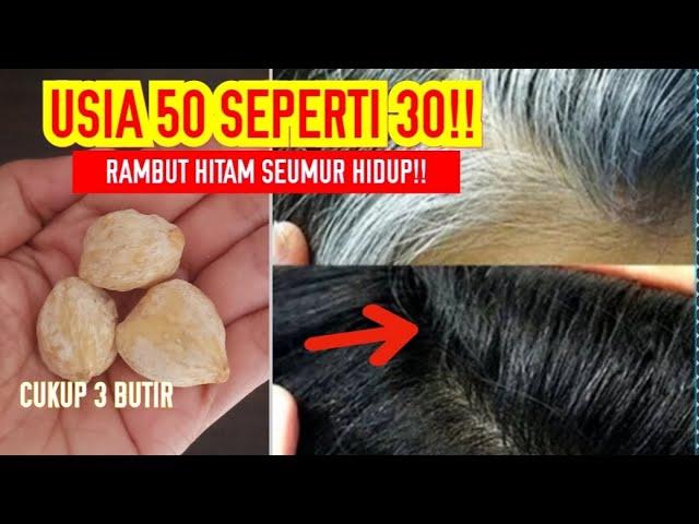 KEMBALI MUDA!!  DI SANGKA SEMIRAN!!  RAMBUT UBAN JADI HITAM  SAMPAI AKARNYA!!