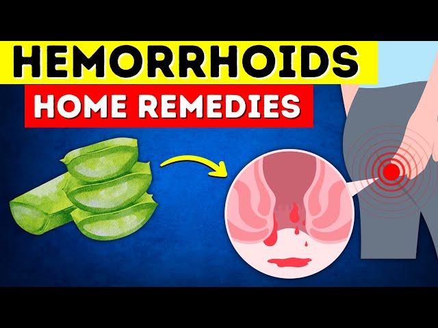 Say Goodbye to Hemorrhoids: 8 Home Remedies That Actually Work