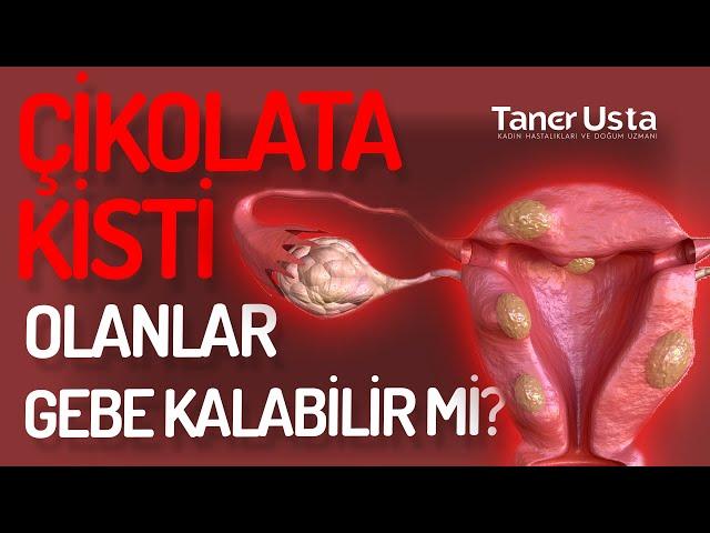 Çikolata Kisti Olanlar Hamile Kalabilir Mi? - Prof. Dr. Taner Usta