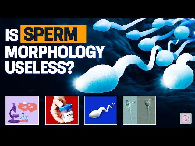 You shouldn't worry about sperm morphology for fertility