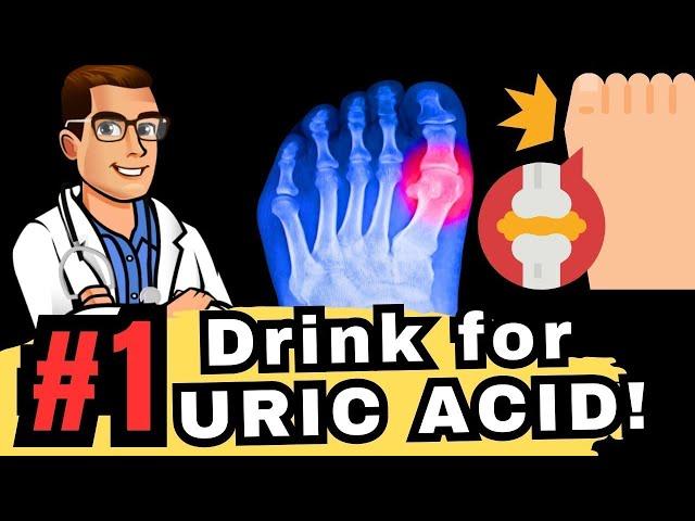 TOP 5 Drinks to Reverse High URIC ACID & GOUT!