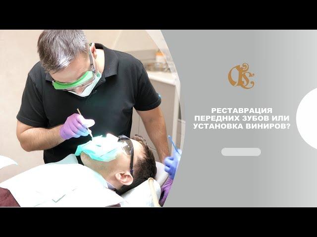 Реставрация передних зубов или установка виниров? Что лучше?