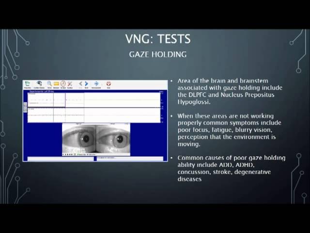 Videonystagmography (VNG) Intro