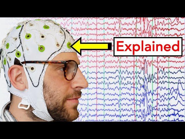 EEG (Electroencephalogram) Explained