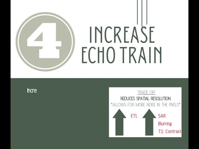 MRI Parameters: 5 Ways to Scan Faster