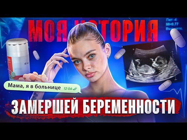 МОЯ ИСТОРИЯ ЗАМЕРШЕЙ БЕРЕМЕННОСТИ. Аня Ищук