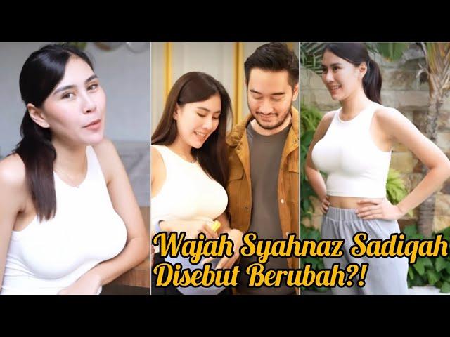 Wow Wajah Syahnaz Sadiqah Disebut Berubah, Makin Besar & Hot, yuk Intip Potret Perubahannya.